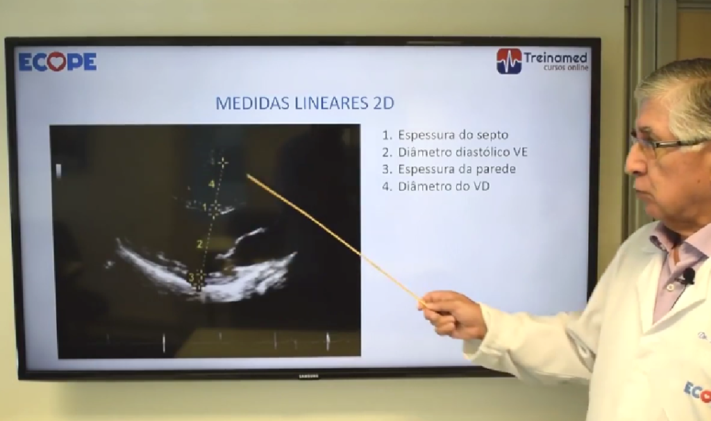 Atualização de Guidelines - Janeiro de 2019 da Sociedade Americana de Ecocardiografia