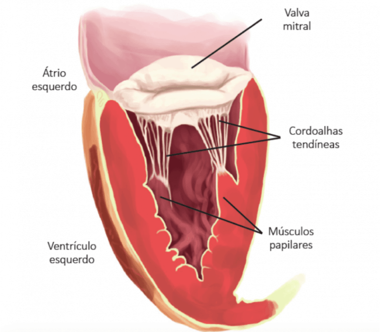 Insuficiência Mitral aspectos etiopatológicos Blog Ecope