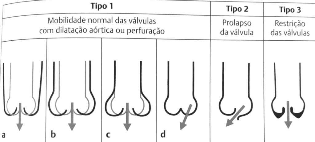 Diretriz-de-Valvopatias