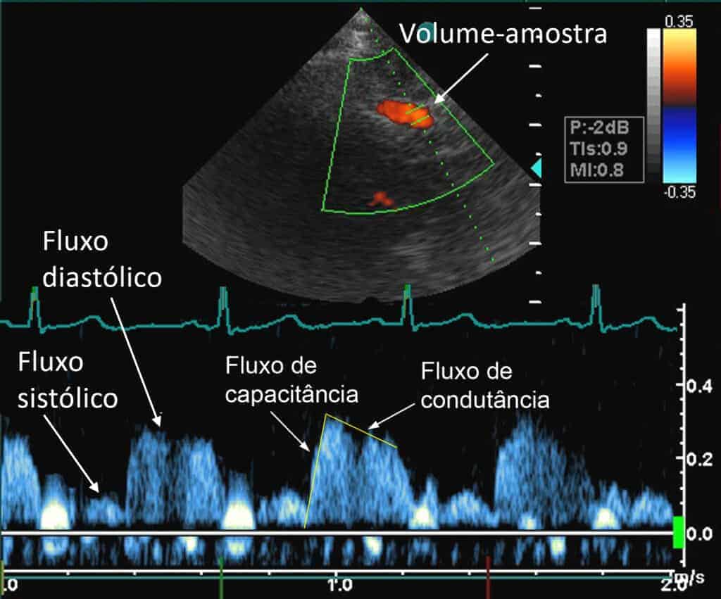 ECOCARDIOGRAFIA-1.jpg