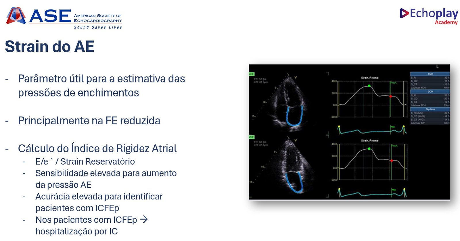 Novo Guideline para Avaliação da Função Diastólica: ASE 2025 (Parte I ...